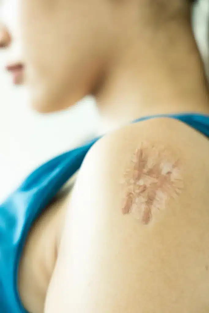A woman is holding a tattooed tattoo on her arm